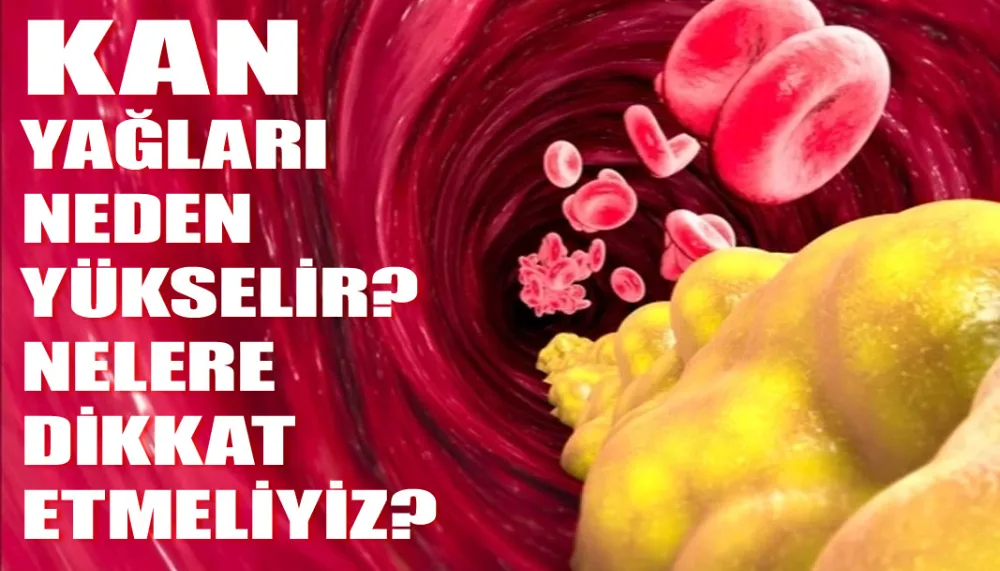 Kan yağları neden yükselir? Nelere dikkat etmeliyiz?