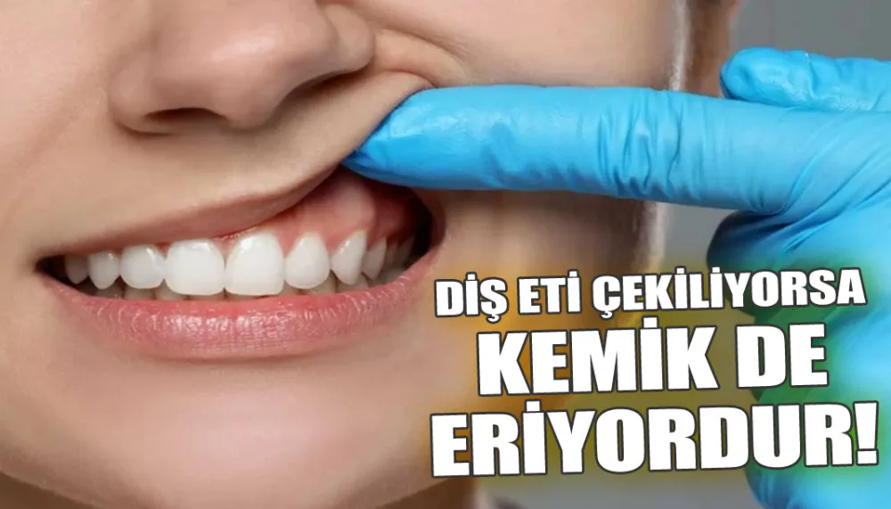 Diş eti çekiliyorsa kemik de eriyordur!